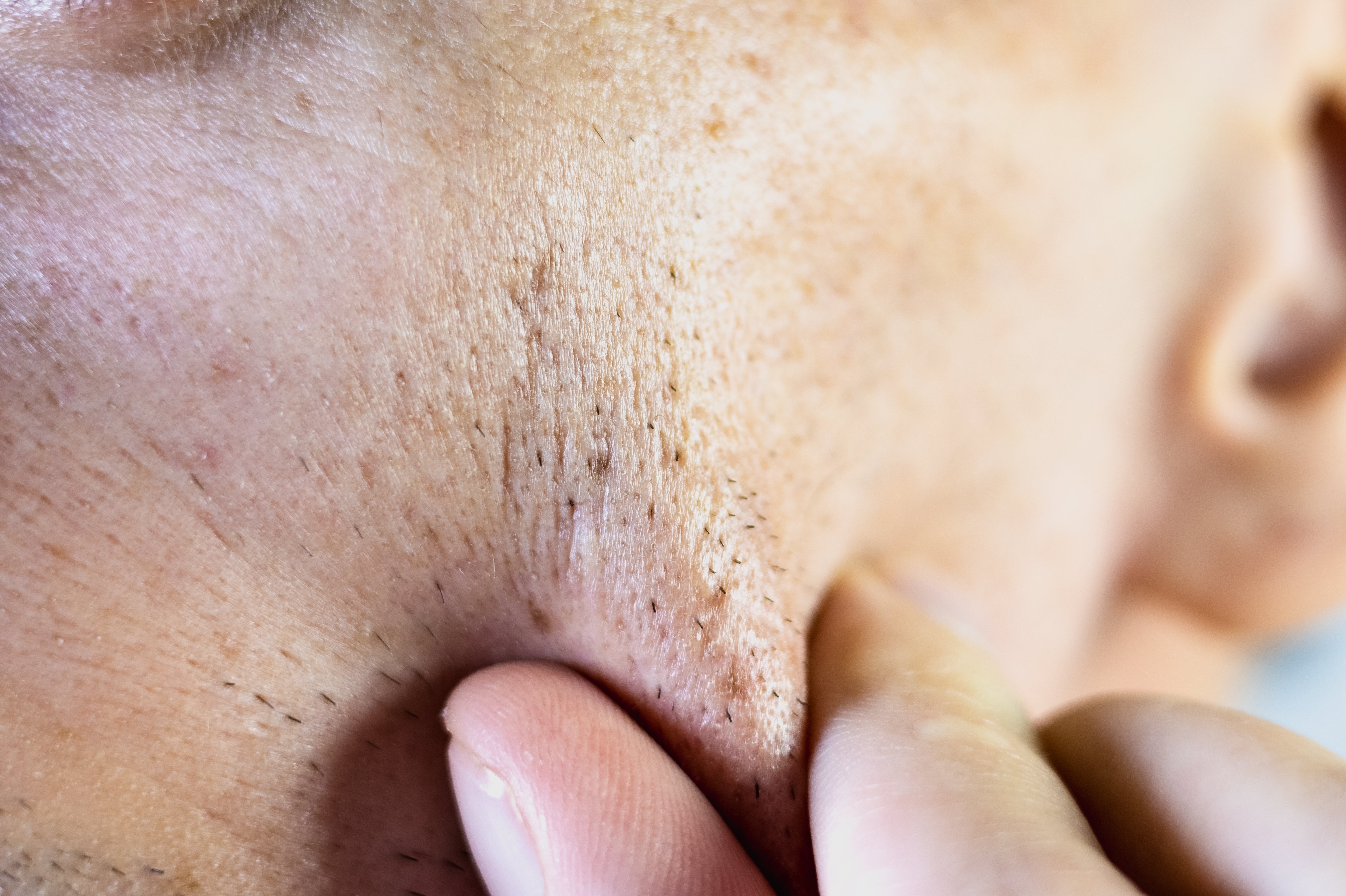 GHK-Cu and Supporting Peptides for Skin Pigmentation – See You Glow